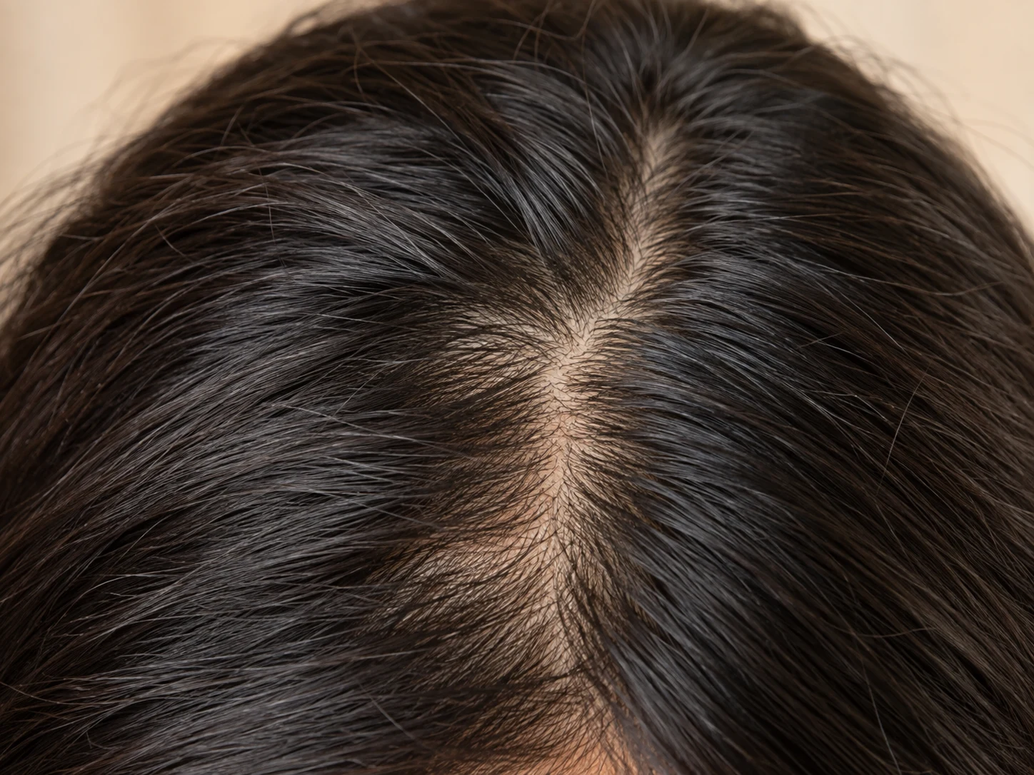 Tricología y alopecia